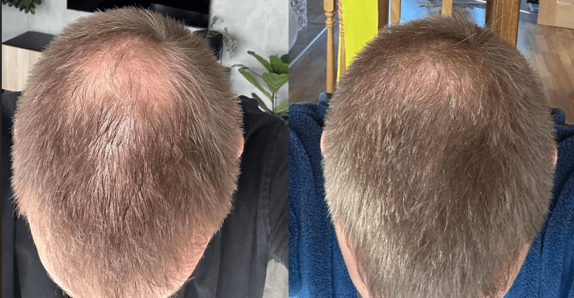 Eli K. Before and After