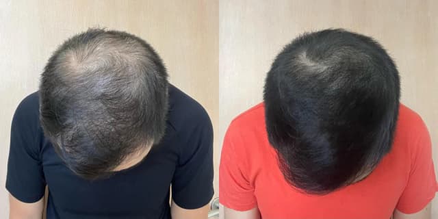 8. You Start to See Results in 30 Days (Not 6-12 Months)