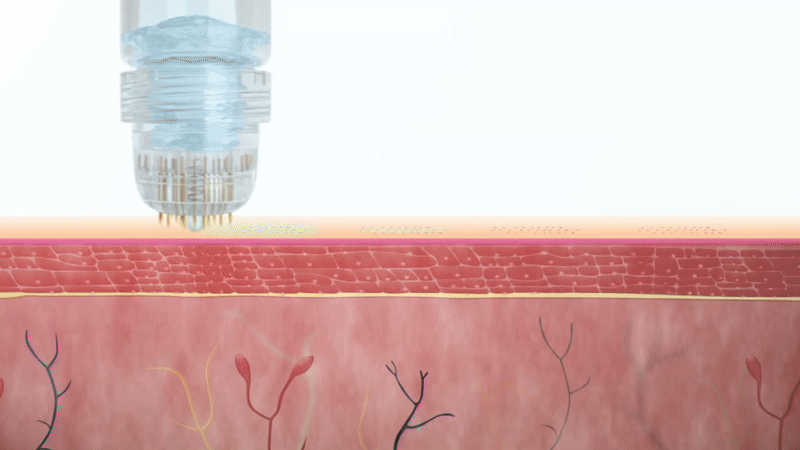 2. It Actually Reaches Where Hair Growth Happens